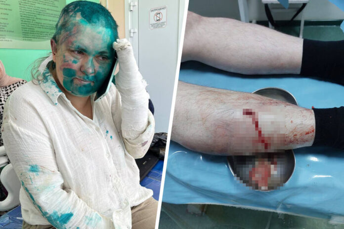 In Grozny, journalist Yelena Milashina was beaten and lawyer Alexander Nemov was stabbed