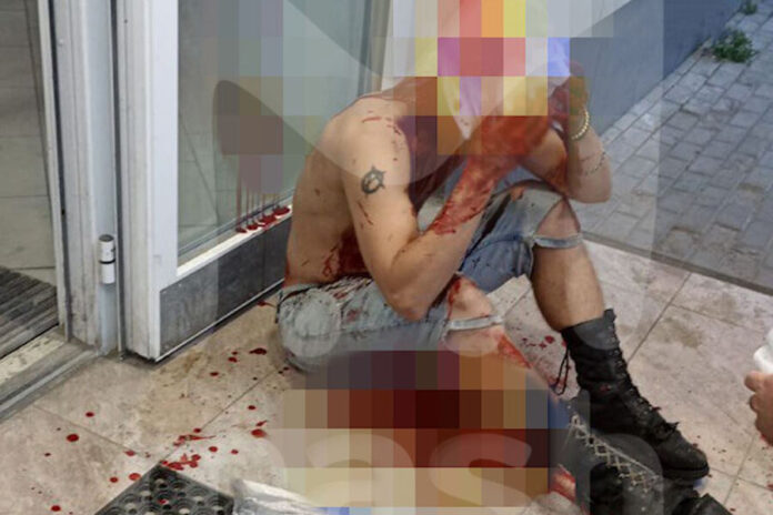 In Elekstrostal, the attackers scalped a local punk because of the color of his hair